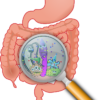irritable bowel image