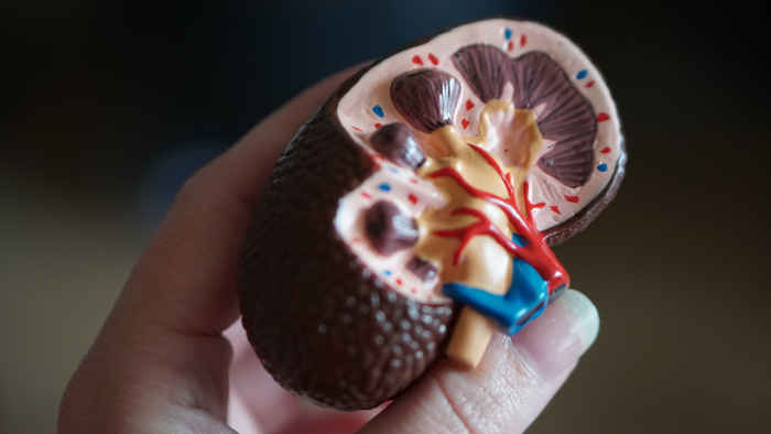 kidney Stones Graphic